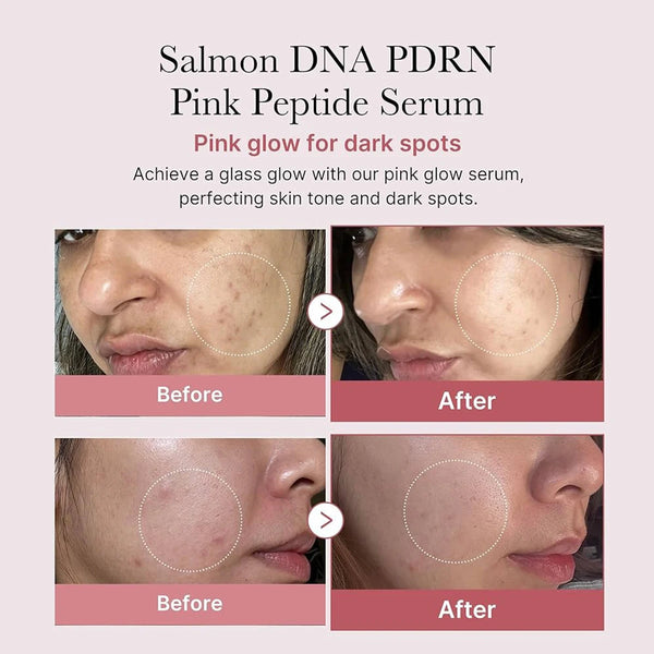 Medicube-Salmon-DNA-PDRN-Pink-Peptide-Serum-Serum-Texture-Complex-Repair-Ingredients-Lifting-Firming-K-Beauty.jpg